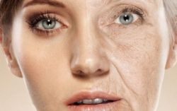 Как предотвратить старение кожи