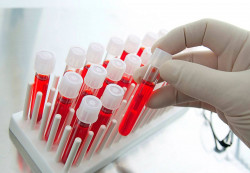 Как сдается и расшифровывается анализ крови на антитела к гельминтам