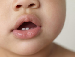 Обезболивающие при прорезывании зубов. Как помочь вашему малышу?